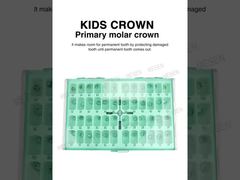 Ein genauerer Blick: KIDS CROWN Milchzahnkrone