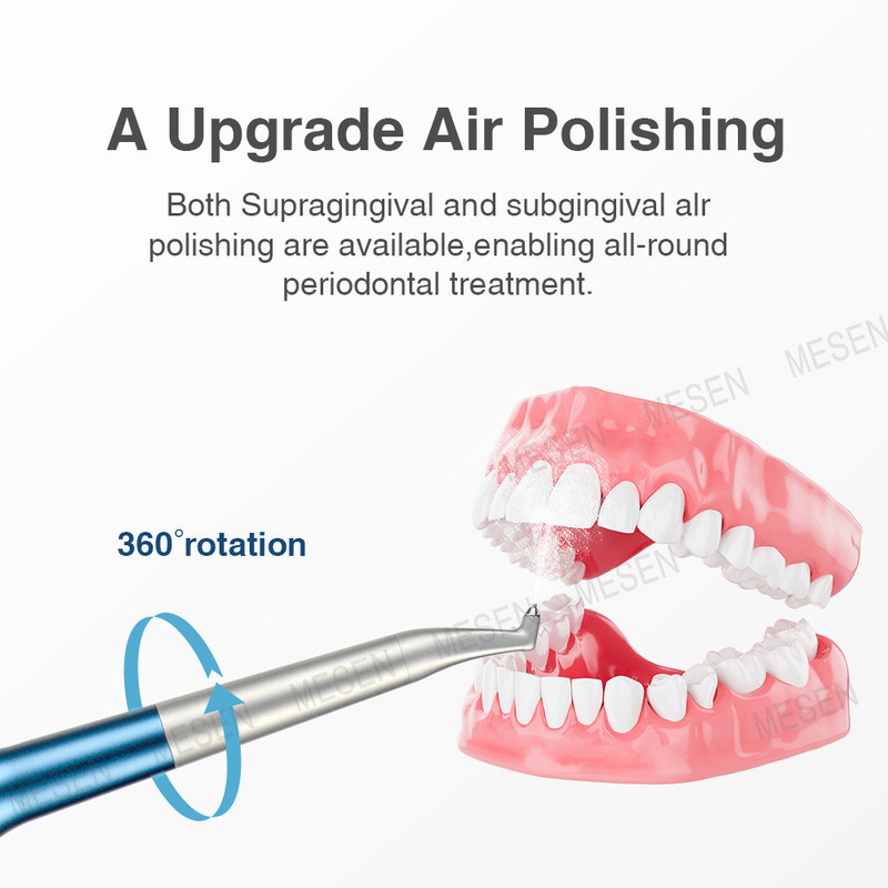 Luftprophy-System Upgrade Luftpolieren Entfernen von Pigmenten, Plaque, Weichschmutz und Frühkalkulation Sandblasen Flasche